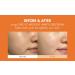 Dr.Ceuracle Pure Vitamin C Mellight Cream | Tone-Up Serum for Face | Anti-Aging Moisturizer | Brighten Dark Spots & Wrinkles | Paraben-Free | Shop Internationally - Buy Online on SooperMarket.com