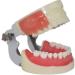Oral Dental Medical Dental Model Of Preparation For Incision And Drainage Of Abscess For Students Teachers And Professionals