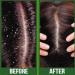 Difeel Premium Castor Plus Tea Tree Hair Oil - Pro-Growth & Scalp Care 2.5 oz - Buy Online on SooperMarket.com