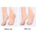 Dekaim Pumice Stone for Feet Foot Scrubber for Dead Skin for Dead Skin Removal Hard Remover Pedicure Prevents Cracked Heels (Grey) - Buy Online on SooperMarket.com