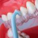 10pcs Aligner Remove Tool Invisible Removable Braces Retainer Aligner Braces Tooth Hook (Random Color) - Buy Online on SooperMarket.com
