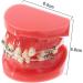 Orthodontic Braces Model Doll-10 - Ceramic Teeth Study for Adults | Ideal for Medical Science & Teaching Research - Buy Online on SooperMarket.com