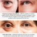 Silk Protein Eye Cream: Anti-Wrinkle & Firming Formula for Dark Circles, Puffiness & Fine Lines - 20g - Buy Online on SooperMarket.com
