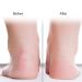 Silicone Socks for Cracked Heels - Moisturizing Heel Protection & Foot Care Tool (S-03#) - Buy Online on SooperMarket.com