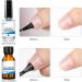 Nail Dehydrator and Primer Bond Set Natural Nail Dehydrant and Max Bond Nail Prep Natural Dehydrate Bond Primer Nail Protein Bond for Gel Nail Polish 15ml - Buy Online on SooperMarket.com