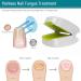 Lanlousy 905NM Nail Therapeutic Instrument Portable Painless Nail Therapy Device Anti- Silicone Easy to Use White - Buy Online on SooperMarket.com