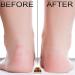 OKAY Papaya Foot Scrub 6 oz - Exfoliating and Moisturizing Foot Care Solution - Buy Online on SooperMarket.com