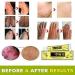 Natural Herbal Cream for Itching Allergy, Dry Skin Relief - Eczema Treatment - Buy Online on SooperMarket.com