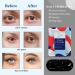 ONIYEA 15-Pack Unscented Steam Eye Masks for Dry Eyes Relief and Puffy Eyes - Disposable Moist Heating Compress Pads for Sleep - SPA Warm Eye Masks for Eye Fatigue - Buy Online on SooperMarket.com