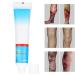 Varicose Vein Treatment Cream - Reduce Inflammation, Improve Circulation | Vein Lotion for Legs & Body - Buy Online on SooperMarket.com