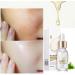 White Rice Serum for Face Exfoliation and Dark Spot Removal - 2PCS Set - Buy Online on SooperMarket.com