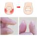 Toenail Tool 6 in 1 Ingrown Toe Nail Fixer Pedicure Toenail Recover Nail Foot Care Kit Ingrown Toenail Corrector for Men Women(24pcs) - Buy Online on SooperMarket.com