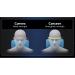 Neck & Shoulder Tension Relief Device - Cervical Traction for Spine Alignment & Decompression - Buy Online on SooperMarket.com