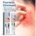 Eczema & Psoriasis Cream - Natural Relief for Dry, Itchy Skin | Scalp Rash Redness Acne - Buy Online on SooperMarket.com
