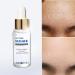 Buy AC Pure Serum | Best International Shipping | High-Quality Skincare - Buy Online on SooperMarket.com