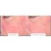 Age Reverse System - Rejuvenate Your Skin & Reverse Aging | Shop Internationally - Buy Online on SooperMarket.com