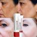 Dark Spot Remover Cream for Face, Body & Sensitive Areas - With Alpha Arbutin, Niacinamide, Collagen, Vitamin E - Powerful Age Spot Corrector - Buy Online on SooperMarket.com