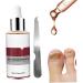 1PC Nail Treatment Nail Renewal Solution Toenails & Fingernails Nail Repairs Essential Oil Protects Toenail Fungus Treatment From Discoloration Brittle And Cracked Nail(12ML) - Buy Online on SooperMarket.com