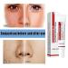 Xing Chen Hai Yang 3Pcs Spot Off Freckle Whitening Cream - Brighten Skin and Fade Freckles - Buy Online on SooperMarket.com