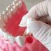 LBYLYH Dental Implant Teeth - Oral Care Brush Model & Educational Dental Template for Early Childhood Learning - Buy Online on SooperMarket.com