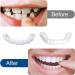 Buy Uqlpxz 2 Pairs Provisional Dental Prosthesis - Affordable Dentures & Cosmetic Teeth for Women & Men - Temporary Veneers & Artificial Teeth - Buy Online on SooperMarket.com