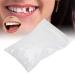Temporary Tooth Repair Beads - 10g Filling Material for Missing/Broken Teeth - Replacement Kit - Buy Online on SooperMarket.com