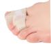 FOMIYES Valgus Nursing Clip Board: Thumb Splints for Arthritis & Toe Separation Pad - 4pcs - Buy Online on SooperMarket.com