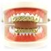 Denture Sets Dental Decorative Brackets Hip Hop Dental Supports Hip Hop Dental Decorations(Gold) - Buy Online on SooperMarket.com