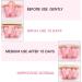2pcs Cotton Umbilical Hernia Belt for Baby | Pink Infant Navel Support Wrap - Buy Online on SooperMarket.com
