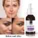 ican London Retinol 0.5% Serum Reducing Wrinkles Lines & Ageing on Face Under Eyes 30ml - Buy Online on SooperMarket.com