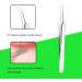 Blackhead Remover Tool Kit - 5-in-1 Stainless Steel Pimple Popper Extractor Set for Face with 4 Tweezers - 0414043 - Buy Online on SooperMarket.com
