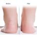 1 Pair Silicone Gel Moisturizing Socks Relieve Plantar Fasciitis Pain Heel Silicone Socks Foot Anti-Cracking Protector Foot Care Tool Prevention Socks (L-White) - Buy Online on SooperMarket.com