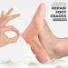 KKPLZZ Moisturizing Silicone Socks | Soft Gel Socks for Cracked Foot Care & Protection | Full Foot Moisture Treatment - Buy Online on SooperMarket.com