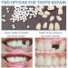 Snap on Smile Braces Instant Perfect Smile Temporary Replacement Tooth Kit for Broken Missing Teeth - Buy Online on SooperMarket.com