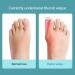 Kenanlan Bunion Corrector for Women - 2PC Toe Splints & Separators for Overlapping Big Toe - Universal Size - Buy Online on SooperMarket.com