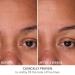 Dr. Dennis Gross DermInfusions Fill + Repair Serum - 1 oz | Fills Lines, Plumps, and Repairs - Buy Online on SooperMarket.com