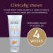 Stretch Marks Removal Cream | Safe for Pregnancy | Dermatologically Tested | All Skin Types | 100g - Buy Online on SooperMarket.com