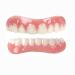 CAILING 1 Set Teeth Molding Kit, Denture Repair Kit for Snap Covering Missing Teeth Denture Filling Kit Braces for Teeth That Look Real, 1 Count 1 Pair