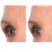 SiO Beauty Mid-Brow Forehead Anti-Wrinkle Patch - Overnight Silicone Patch for Furrows, Expression Lines, and 11s - Buy Online on SooperMarket.com