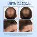 Bosley Bos-Revive Thickening Treatment for Non Color-Treated Hair - 6.8 fl oz (200 ml) - Buy Online on SooperMarket.com