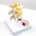 Model of Human Spine Detachable Medical Teaching Model Lumbar Spine Injuries with 2 Intervertebral Disc Model Model - Buy Online on SooperMarket.com
