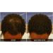 Dr. Yates MD Keratin Fiber Hair Enhancer - Dark Brown | Instantly Thicker Hair Solution - Buy Online on SooperMarket.com