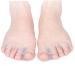 GLEAVI Thumb Splints 4 Pair Set - Thumb Dividers & Toe Separators for Bunion Relief & Orthotic Support - Buy Online on SooperMarket.com