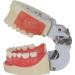 Professional Dental Model for Incision & Drainage of Abscess - Ideal for Students & Educators | International Shipping - Buy Online on SooperMarket.com