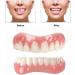 Temporary Dental Veneers for Natural Teeth Restoration - Upper & Lower Jaw, Natural Shade - Buy Online on SooperMarket.com