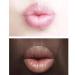 H.D.S.N. Lip Pink Fast Lightening Balm Treatment - 2PCS Set for Dark Lips Removal - Buy Online on SooperMarket.com