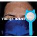Woods Lamp Skin Analyzer Professional Wood's Lamp Vitiligo Ringworm Detection Light Wood Lamp with with Magnifying Wood S Lamp for Skin Testing - Buy Online on SooperMarket.com