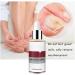 1PC Nail Treatment Toenail Treatment Nail Renewal Solution Toenails & Fingernails Nail Repairs Essential Oil Protects From Discoloration Brittle And Cracked Nail(12ML) - Buy Online on SooperMarket.com