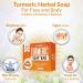 Organic Turmeric Soap Bar | Handcrafted in USA with Calendula & Aloe Vera | Brightens Skin, Fades Scars, Evens Tone | Face & Body Cleanser for Sun Damage & Age Spots - Buy Online on SooperMarket.com