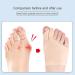 IYSHOUGONG Big Toe Hallux Valgus Corrector - Silicone Feet Care for Bone Thumb Alignment - Buy Online on SooperMarket.com